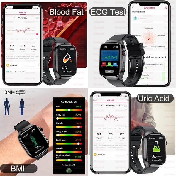 2025 New For Xiaomi Five organ examination Smart Watch Men ECG+PPG Uric Acid Blood Fat Bluetooth Call Sports Health Smartwatches